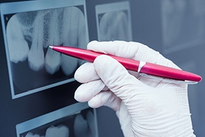 Pen pointing to digital dental x-rays