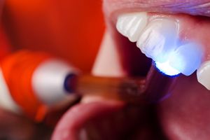 dental light