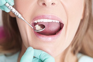 Closeup of woman receiving dental exam