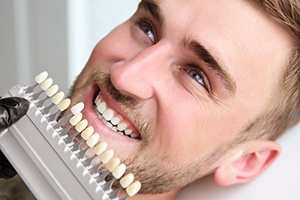 Man's smile compared with tooth color chart