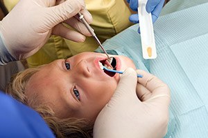 Child receiving fluoride treatment