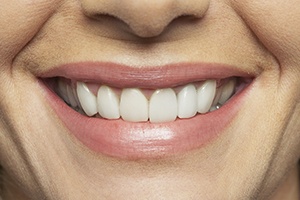 Closeup of flawless healthy smile