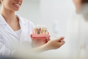 woman holding dental implant model